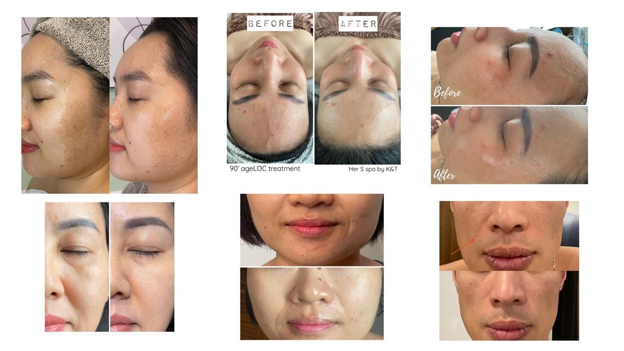 Immediate results from the first experience